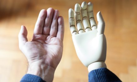 New techniques show people with artificial hands rely heavily on intact limb