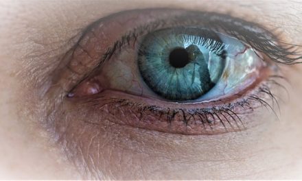 Why you need to be careful wearing glitter on your eyes this party season