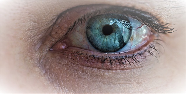 Why you need to be careful wearing glitter on your eyes this party season