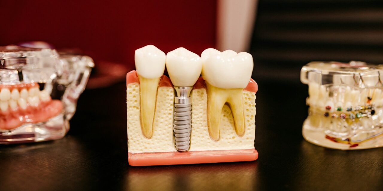 Accessing Reliable Dental Care in Balham and South London