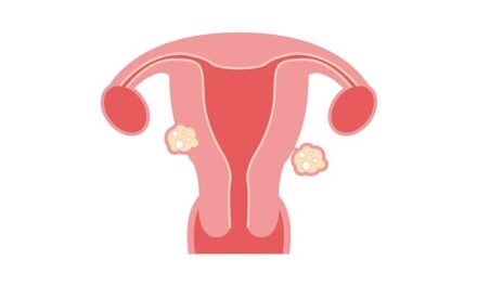 Fibroids Awareness Month 2025: Understanding, Empowering, and Supporting Women’s Health