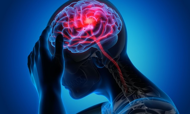 Migraine photo