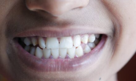 Why Your Teeth Don’t Feel as Clean as You Think
