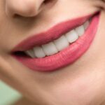 Full-Arch Implant Treatment Abroad: Why Two Visits Are Required and What Each Involves