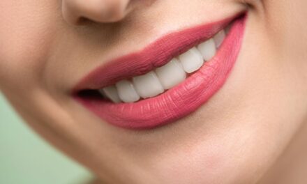 Full-Arch Implant Treatment Abroad: Why Two Visits Are Required and What Each Involves
